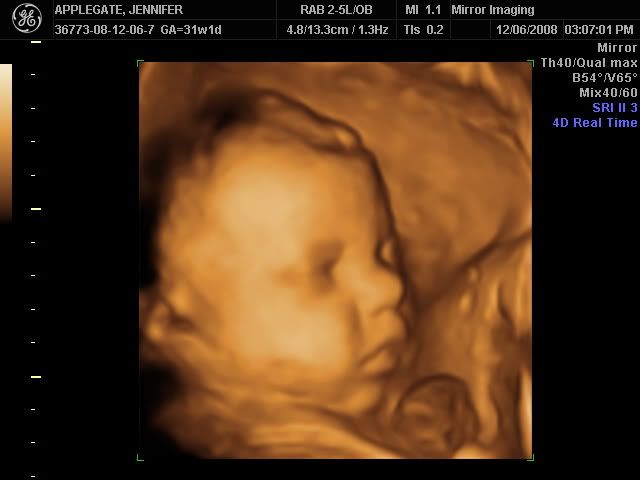 12 Weeks Pregnant Pictures 3d Ultrasound
