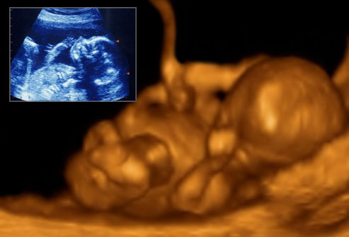 12 Weeks Pregnant Ultrasound Gender