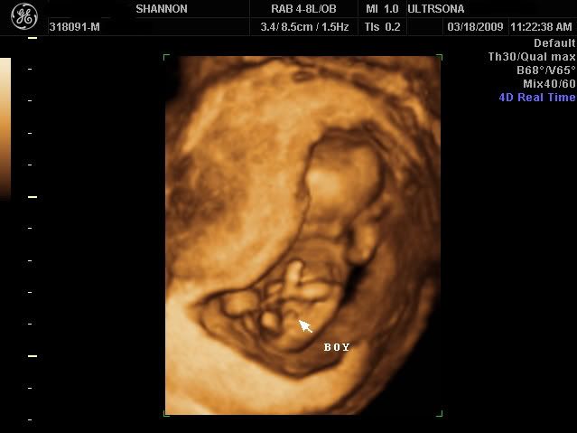 12 Weeks Pregnant Ultrasound Gender