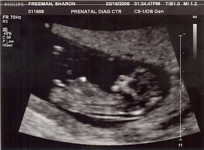 12 Weeks Pregnant Ultrasound Pictures