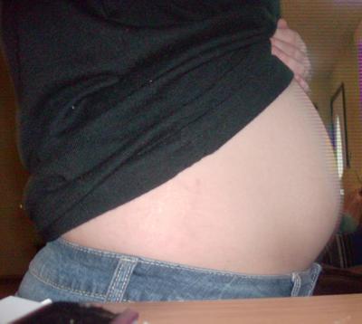 12 Weeks Pregnant With Twins Symptoms