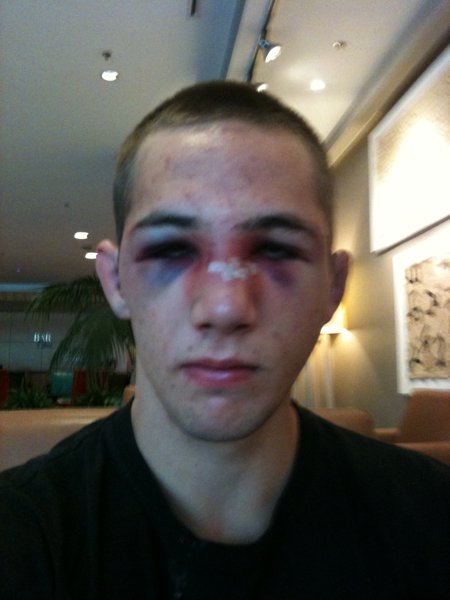 Gsp Vaseline