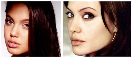 Angelina Jolie Lips Before Surgery