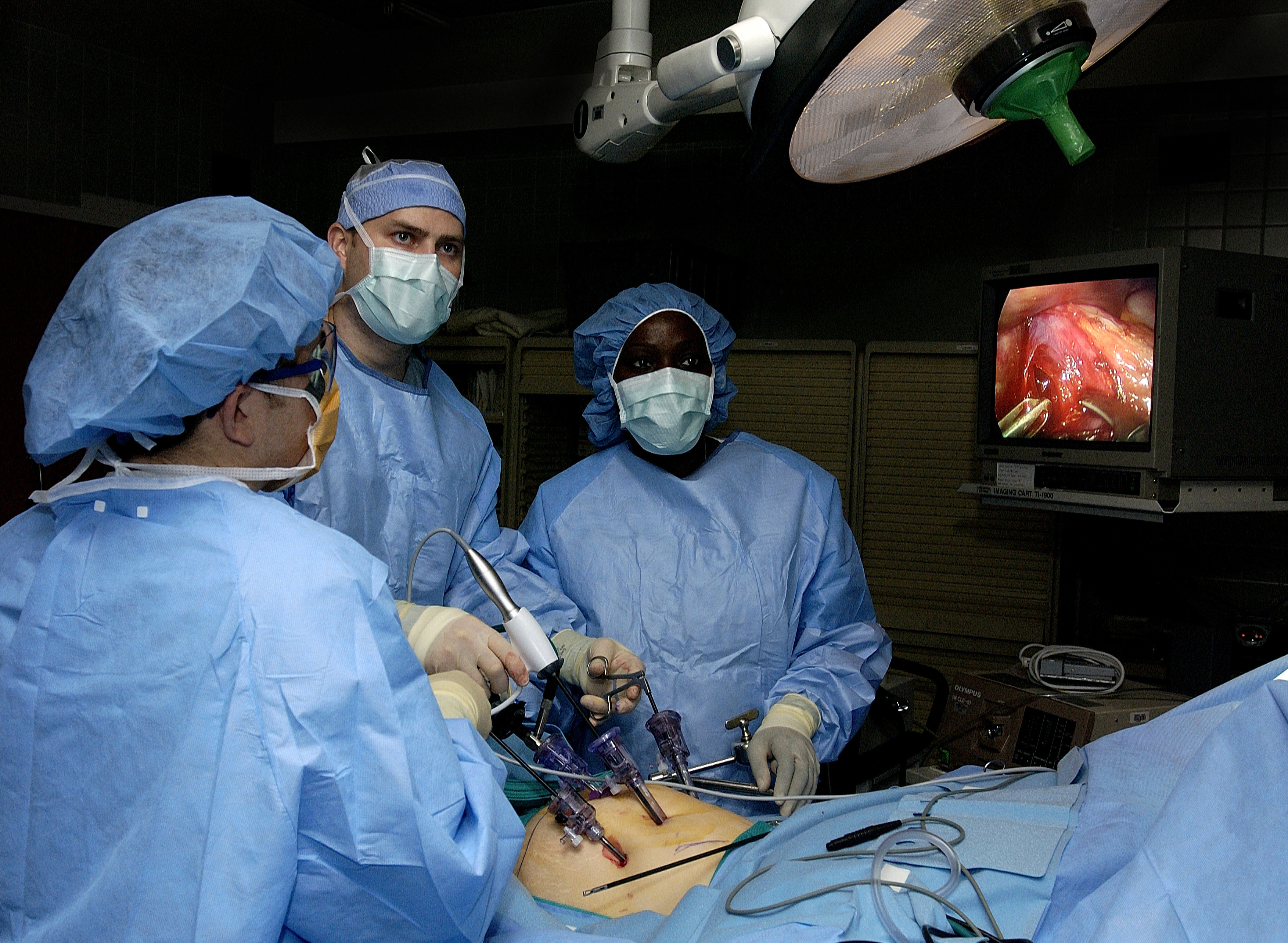 Appendix Removal Procedure