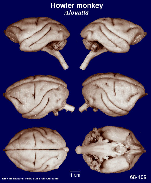 Brain Anatomy Quizlet