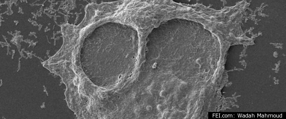 Breast Cancer Cells Dividing