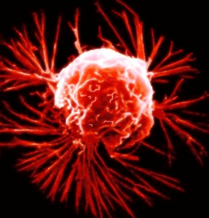 Breast Cancer Cells Dividing