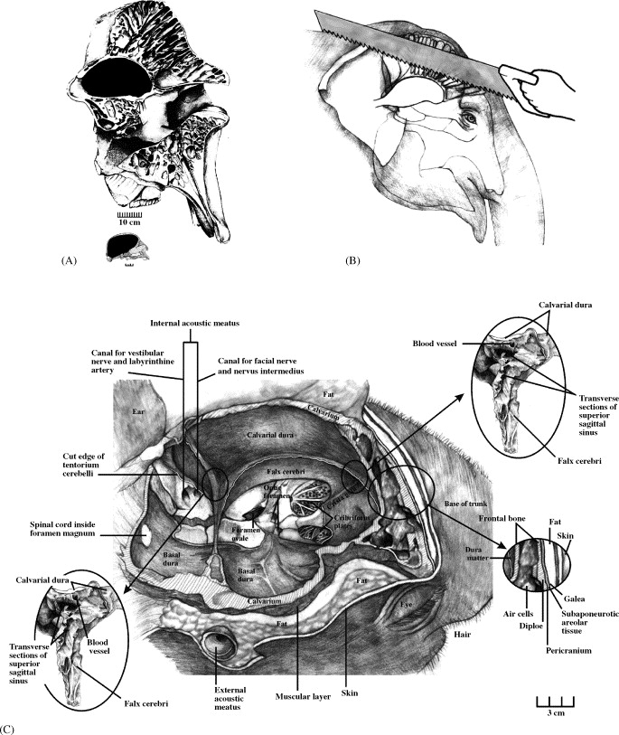 Elephant Lungs Anatomy