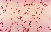 Escherichia Coli Gram Stain Results