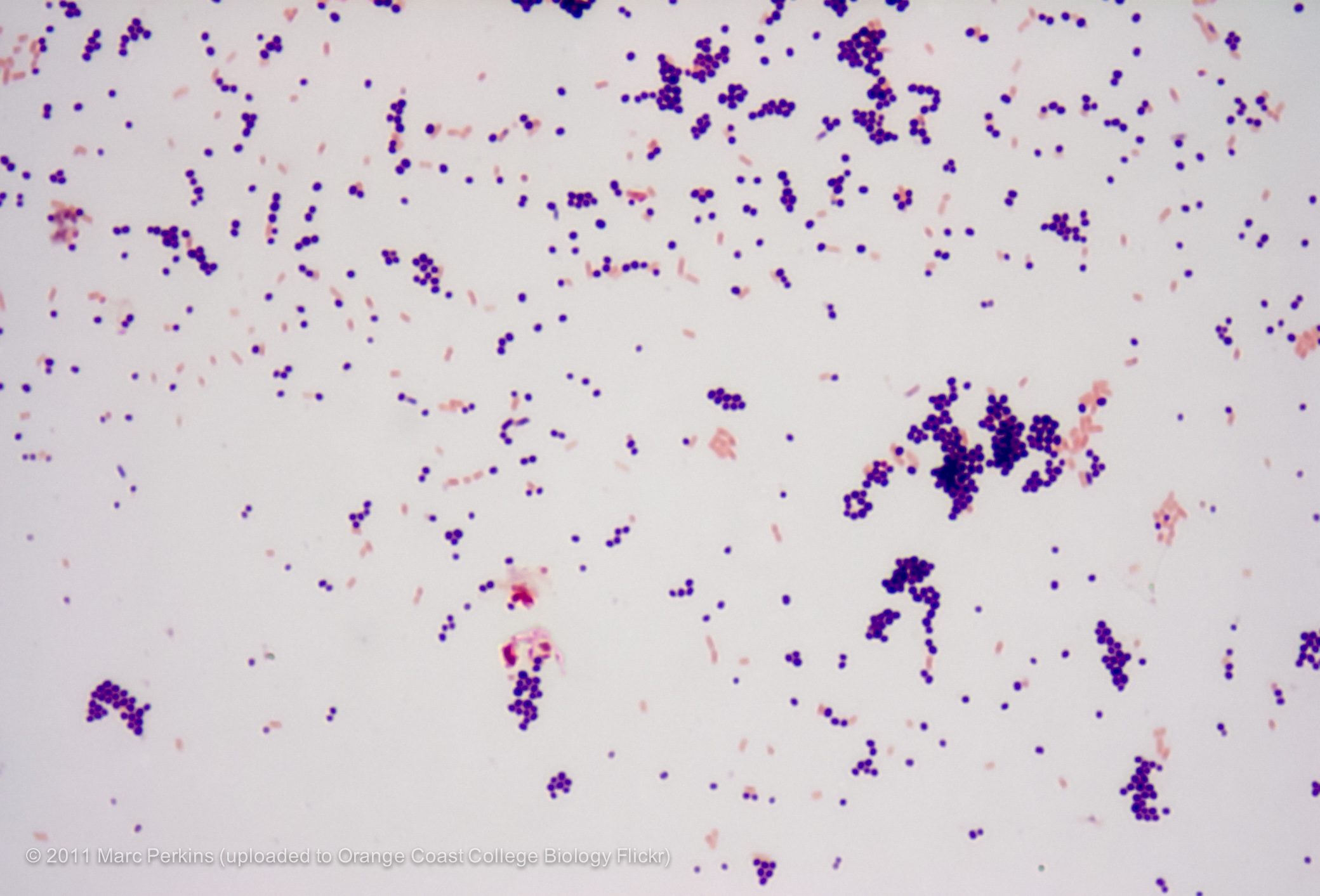Escherichia Coli Gram Stain Results