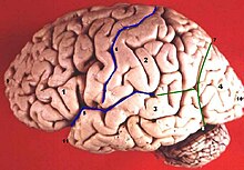 Frontal Lobe Dementia Causes