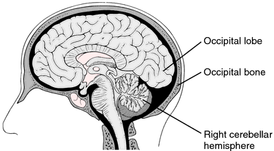 Frontal Lobe Dementia Wiki