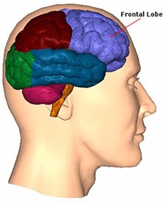 Frontal Lobe Dementia Wiki