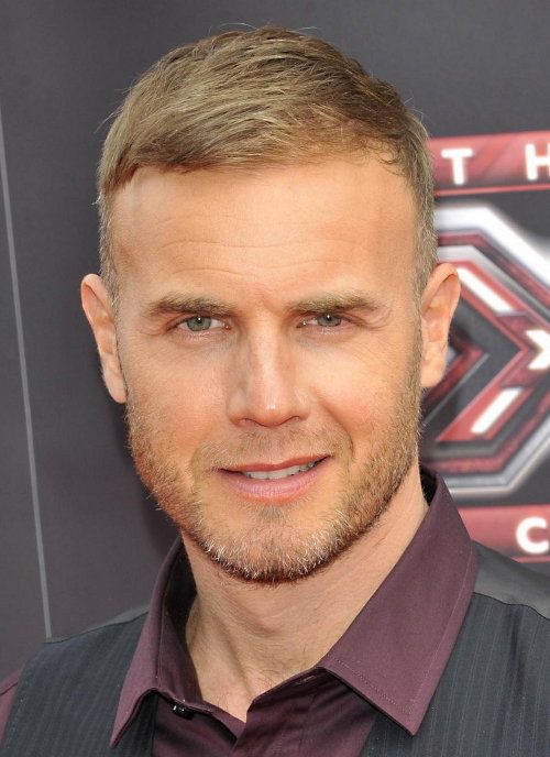 Gary Barlow Hair Loss
