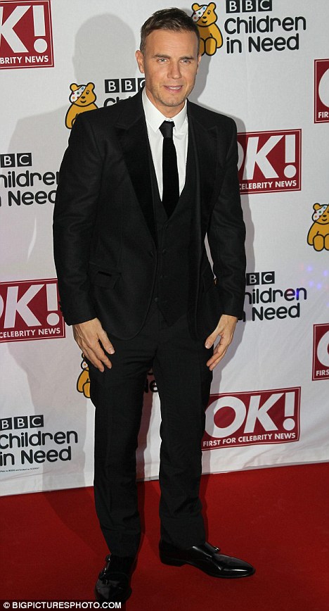 Gary Barlow Hair Loss