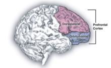 Left Frontal Lobe Damage