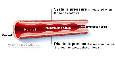 Lifestyle Factors Affecting Blood Pressure