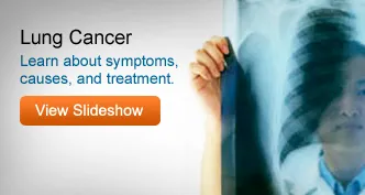 Lungs Cancer Symptoms Women