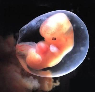 Miscarriage At 6 Weeks Pictures
