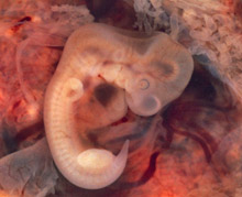 Miscarriage At 7 Weeks What Does It Look Like